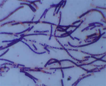 Anthrax bacteria is a rod-shaped culture. Most common forms of transmission are through abrasions in the skin and inhalation.